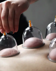 🔥Hot Sale - 49% OFF🔥Thickened Vacuum Cupping Set with Suction Pump