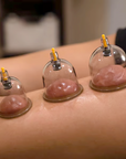 🔥Hot Sale - 49% OFF🔥Thickened Vacuum Cupping Set with Suction Pump