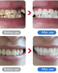 💎UP TO 50% OFF!!🦷✨Electric Ultrasonic Dental Scaler for Tartar and Plaque Removal