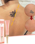 🔥 50% OFF · Gentle Effective Multi-Use Tattoo Fading Cream ✨