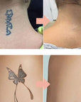🔥 50% OFF · Gentle Effective Multi-Use Tattoo Fading Cream ✨