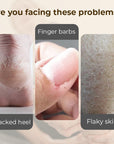 🧴Hydrating and Anti-Cracking Foot Cream