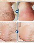 🧴Hydrating and Anti-Cracking Foot Cream