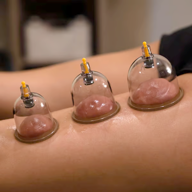 🔥Hot Sale - 49% OFF🔥Thickened Vacuum Cupping Set with Suction Pump